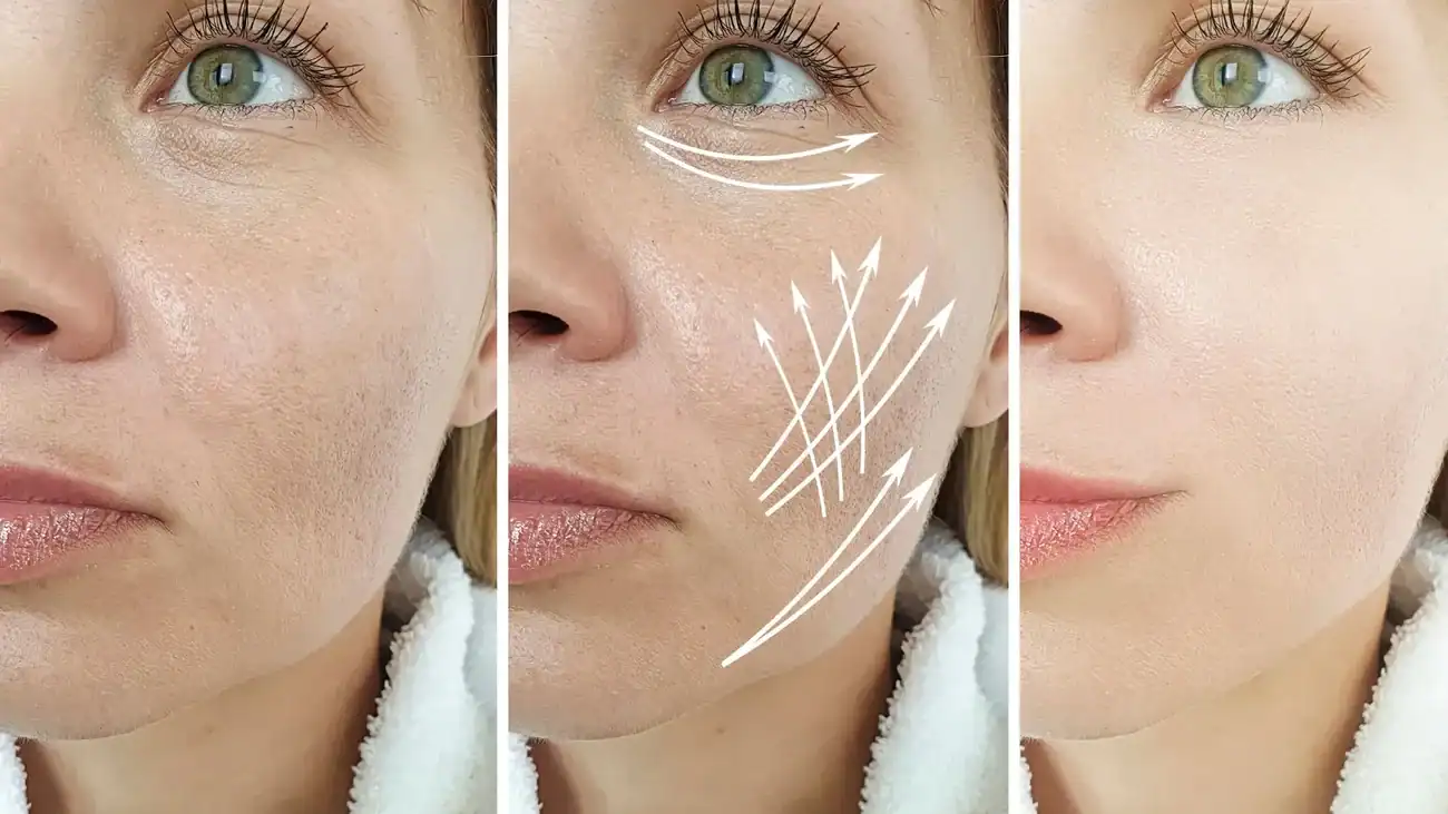 Can One Treatment Really Tackle More Than One Skin Concern Ashtead?