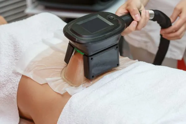 Image of person having fat freezing treatment to help weight gain Ashtead