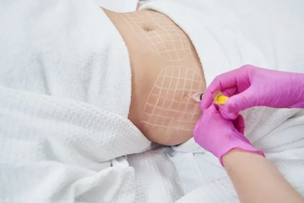 image of fat dissolving injections on love handles to help combat weight gain Ashtead