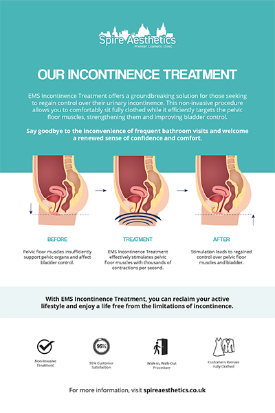 image to show how EMS treatment works for female urinary incontinence Ashtead