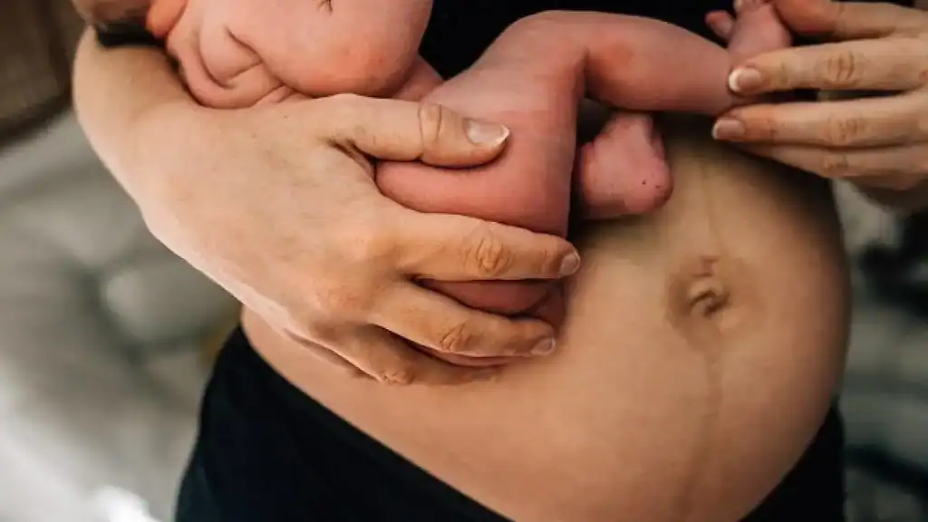 Why Is My Stomach Still Big After Pregnancy Ashtead?